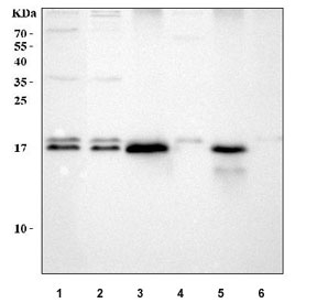Western blot testing of 1) human HeLa, 2) human SH-SY5Y, 3) rat small intestine, 4) rat liver, 5) mouse small intestine and 6) mouse liver tissue lysate with RBP2 antibody. Predicted molecular weight ~16 kDa.