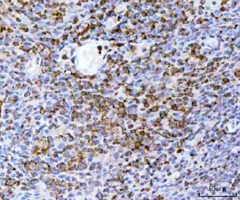 IHC staining of FFPE human tonsil tissue with TRAILR2 antibody. HIER: boil tissue sections in pH8 EDTA for 20 min and allow to cool before testing.