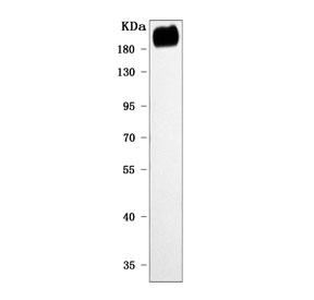 Western blot testing of mouse skeletal muscle tissue with PREX2 antibody. Predicted molecular weight ~183 kDa.