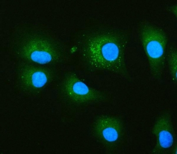 Immunofluorescent staining of FFPE human A549 cells with Glucosidase 2 subunit beta antibody (green) and DAPI nuclear stain (blue). HIER: steam section in pH6 citrate buffer for 20 min.