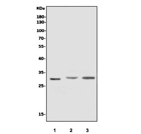 Western blot testing of human 1) U-87 MG, 2) rat kidney and 3) mouse kidney tissue lysate with Superoxide Dismutase 3 antibody. Predicted molecular weight: 26-32 kDa.