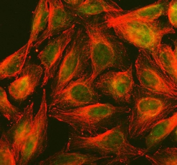Immunofluorescent staining of FFPE human U-2 OS cells with PPP2R5D antibody (green) and Alpha Tubulin mAb (red). HIER: steam section in pH6 citrate buffer for 20 min.