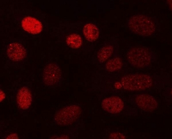 Immunofluorescent staining of FFPE human U-2 OS cells with PPP3CA antibody (red). HIER: steam section in pH6 citrate buffer for 20 min.