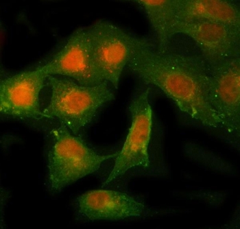 Immunofluorescent staining of FFPE human A549 cells with NBR1 antibody (red) and Beta Tubulin mAb (green). HIER: steam section in pH6 citrate buffer for 20 min.