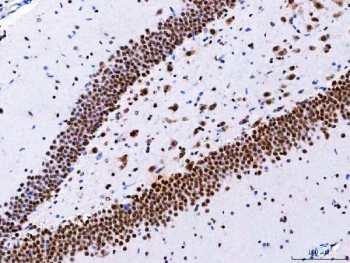 IHC staining of FFPE rat hippocampus tissue with CBP80 antibody. HIER: boil tissue sections in pH8 EDTA for 20 min and allow to cool before testing.