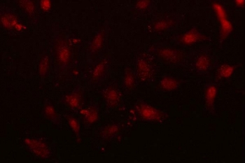 Immunofluorescent staining of FFPE human A549 cells with NFIX antibody (red) and DAPI nuclear stain (blue). HIER: steam section in pH6 citrate buffer for 20 min.