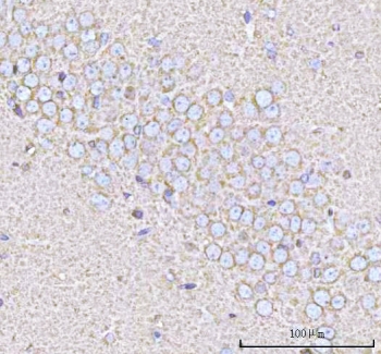 IHC staining of FFPE rat brain tissue with Calcineurin B antibody. HIER: boil tissue sections in pH8 EDTA for 20 min and allow to cool before testing.