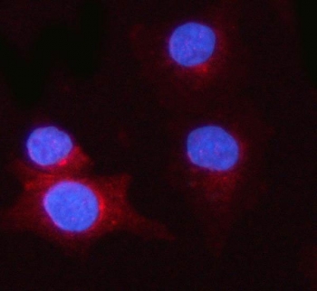 Immunofluorescent staining of FFPE human A549 cells with PSME1 antibody (red) and DAPI nuclear stain (blue). HIER: steam section in pH6 citrate buffer for 20 min.