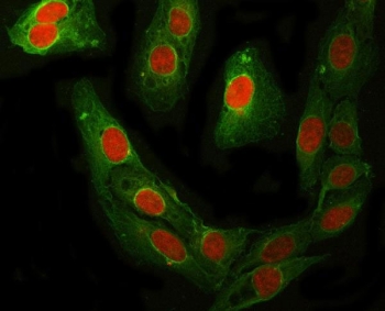 Immunofluorescent staining of FFPE human U-2 OS cells with RFC4 antibody (red) and Beta Tubulin mAb (green). HIER: steam section in pH6 citrate buffer for 20 min.
