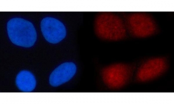 Immunofluorescent staining of FFPE human HeLa cells with N4BP1 antibody (red) and DAPI nuclear stain (blue). HIER: steam section in pH6 citrate buffer for 20 min.