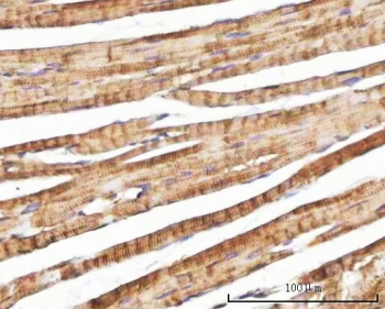 IHC staining of FFPE mouse heart tissue with Nebulette antibody. HIER: boil tissue sections in pH8 EDTA for 20 min and allow to cool before testing.