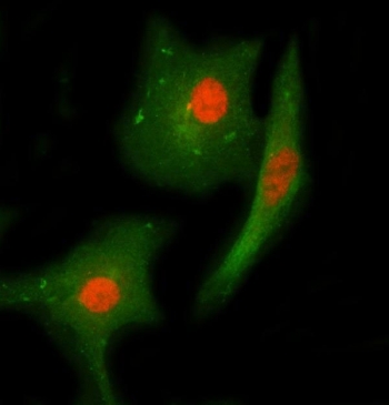 Immunofluorescent staining of FFPE human A549 cells with Checkpoint kinase 2 antibody (red) and Beta Tubulin mAb (green). HIER: steam section in pH6 citrate buffer for 20 min.