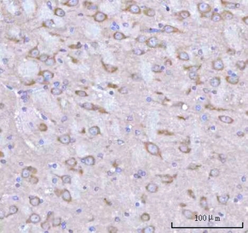 IHC staining of FFPE rat brain tissue with Rabphilin 3A antibody. HIER: boil tissue sections in pH8 EDTA for 20 min and allow to cool before testing.