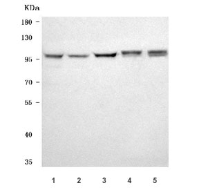 Western blot testing of 1) human HeLa, 2) human 293T, 3) human K562, 4) rat brain and 5) mouse brain tissue lysate with NAA15 antibody. Predicted molecular weight ~101 kDa.