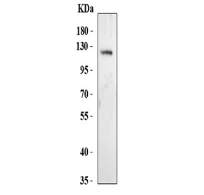 Western blot testing of human 293T cell lysate with NALP9 antibody. Predicted molecular weight ~113 kDa.