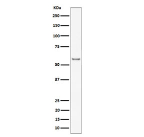 Western blot testing of mouse heart tissue lysate with Intercellular adhesion molecule 2 antibody. Expected molecular weight: 31-60 kDa depending on glycosylation level.