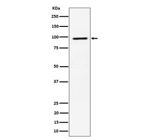 Western blot testing of human MCF7 cell lysate with RSK2 antibody. Predicted molecular weight ~84 kDa, commonly observed at 84-90 kDa.