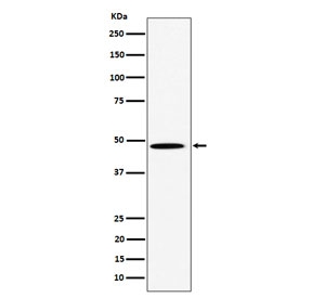 Western blot testing of human HeLa cell lysate with P4HTM antibody. Predicted molecular weight: 47-63 kDa (three isoforms).