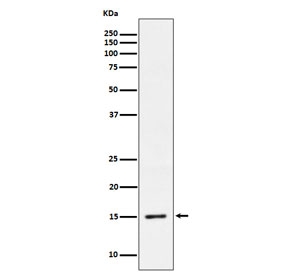 Western blot testing of lysate from HeLa cells treated with Calyculin A.