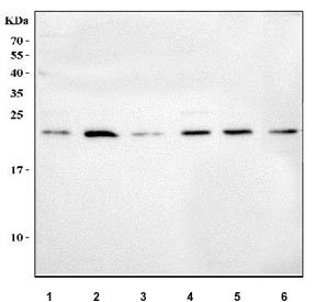 Western blot testing of 1) human A549, 2) human SiHa, 3) human ThP-1, 4) human U-251, 5) rat testis and 6) mouse testis tissue lysate with MSRB3 antibody. Predicted molecular weight ~21 kDa.