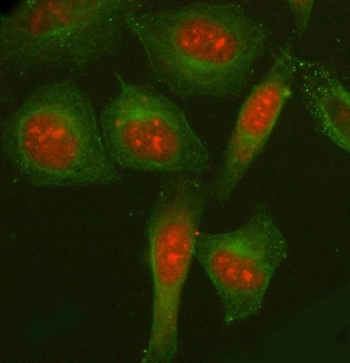 Immunofluorescent staining of FFPE human HeLa cells with NCOA5 antibody (red) and Beta Tubulin mAb (green). HIER: steam section in pH6 citrate buffer for 20 min.