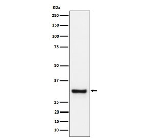 Western blot testing of human plasma cell lysate with ADIPOQ antibody. Predicted molecular weight ~30 kDa.