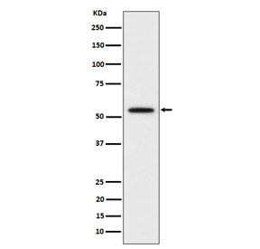 Western blot testing of human Hela cell lysate with KATNA1 antibody. Predicted molecular weight ~56 kDa.