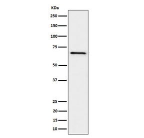 Western blot testing of human Ramos cell lysate with GRK6 antibody. Predicted molecular weight ~66 kDa.