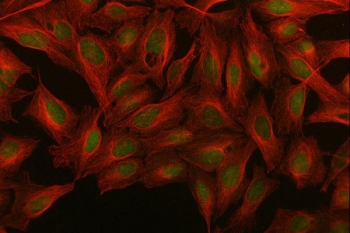 Immunofluorescent staining of FFPE human U-2 OS cells with MED26 antibody (green) and Beta Tubulin mAb (red). HIER: steam section in pH6 citrate buffer for 20 min.
