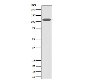 Western blot testing of human HeLa cell lysate with ZHX2 antibody. Predicted molecular weight ~92 kDa, commonly observed at 92-110 kDa.