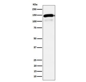Western blot testing of human HepG2 cell lysate with Phospholipase C-beta-1 antibody. Predicted molecular weight ~139 kDa.