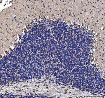 IHC staining of FFPE mouse cerebellum tissue with MTCL1 antibody. HIER: boil tissue sections in pH8 EDTA for 20 min and allow to cool before testing.