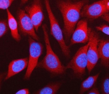 Immunofluorescent staining of FFPE human HeLa cells with MPHOSPH9 antibody (red) and DAPI nuclear stain (blue). HIER: steam section in pH6 citrate buffer for 20 min.