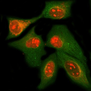 Immunofluorescent staining of FFPE human HeLa cells with MPHOSPH10 antibody (red) and Beta Tubulin mAb (green). HIER: steam section in pH6 citrate buffer for 20 min.