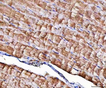 IHC staining of FFPE human skeletal muscle tissue with NT5C1A antibody. HIER: boil tissue sections in pH8 EDTA for 20 min and allow to cool before testing.