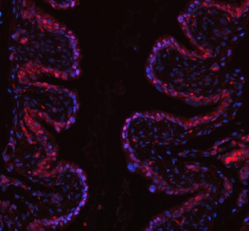 Immunofluorescent staining of FFPE mouse bladder tissue with PUS7 antibody (red) and DAPI nuclear stain (blue). HIER: steam section in pH8 EDTA buffer for 20 min.