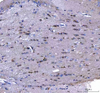 IHC staining of FFPE rat brain tissue with MAP6D1 antibody. HIER: boil tissue sections in pH8 EDTA for 20 min and allow to cool before testing.