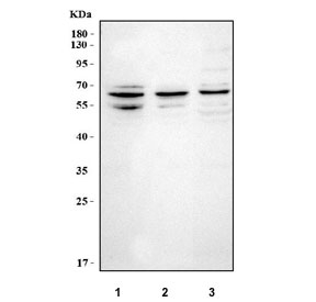 Western blot testing of human 1) SH-SY5Y, 2) Caco-2 and 3) K562 cell lysate with NT5DC2 antibody. Predicted molecular weight ~61/64/46 kDa (multiple isoforms).