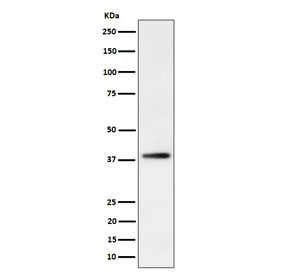 Western blot testing of human HepG2 cell lysate with Farnesyl Diphosphate Synthase antibody. Predicted molecular weight: 48/41 kDa (two isoforms).