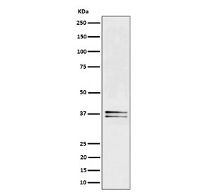 Western blot testing of human Jurkat cell lysate with LAT antibody. Expected molecular weight: 36-38 kDa.