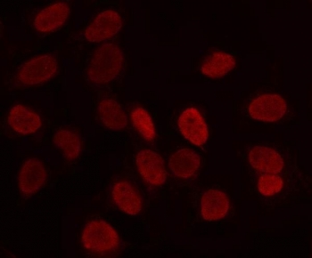 Immunofluorescent staining of FFPE human HeLa cells with LRIG2 antibody (red).