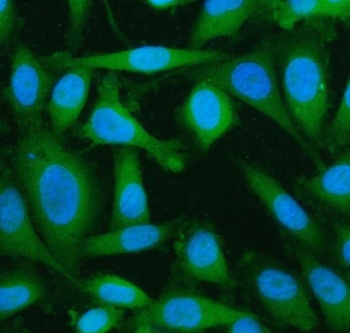 Immunofluorescent staining of FFPE human PC-3 cells with LYPLA2 antibody (green) and DAPI nuclear stain (blue). HIER: steam section in pH6 citrate buffer for 20 min.
