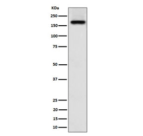 Western blot testing of human A673 cell lysate with ZFYVE9 antibody. Predicted molecular weight ~156 kDa.
