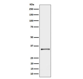 Western blot testing of human A431 cell lysate with Cytochrome b5 reductase 3 antibody. Predicted molecular weight ~34 kDa.