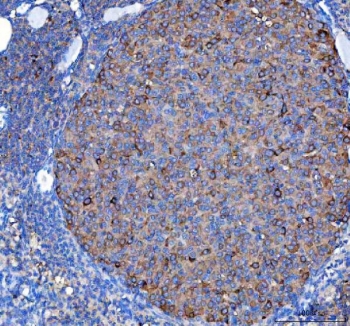 IHC staining of FFPE mouse ovary tissue with Diphosphomevalonate decarboxylase antibody. HIER: boil tissue sections in pH8 EDTA for 20 min and allow to cool before testing.