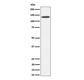 Western blot testing of human HepG2 cell lysate with CDH4 antibody. Expected molecular weight: 100-140 kDa depending on glycosylation level.