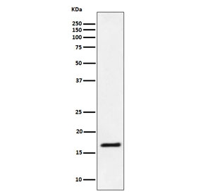 Western blot testing of human Jurkat cell lysate with UBE2L3 antibody. Predicted molecular weight ~18 kDa.