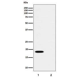 Western blot testing of lysate from 1) human HUVEC and 2) human HUVEC treated with alkaline phosphatase, using phospho-PTS antibody.