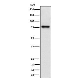 Western blot testing of human HepG2 cell lysate with TRIP10 antibody. Expected molecular weight: 40-85 kDa (multiple isoforms).