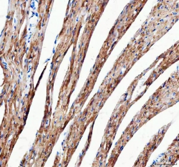 IHC staining of FFPE mouse heart tissue with Mitofilin antibody. HIER: boil tissue sections in pH8 EDTA for 20 min and allow to cool before testing.